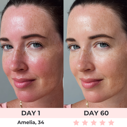 Eccoba™ - Red Light Therapy Mask